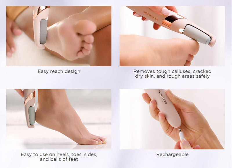 Portable Callus Remover - 50% OFF Today Only